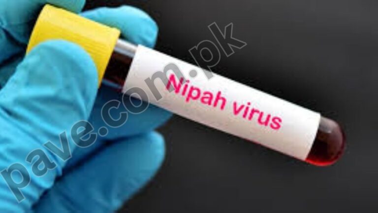 What Are Nipah Virus Symptoms and Treatment Revealed 3 What Are Nipah Virus Symptoms and Treatment Revealed